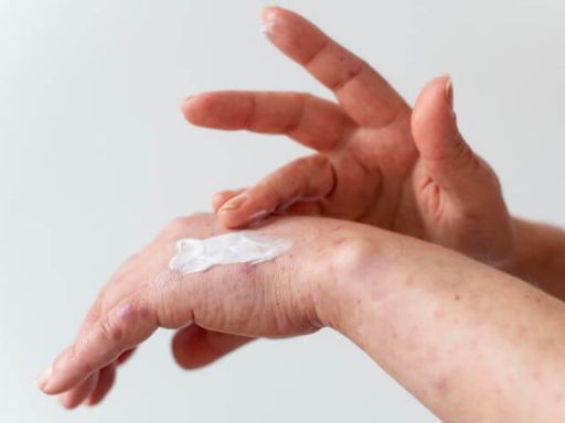 Profissionais da equipe multidisciplinar oncológica: dermatologista Profissionais da equipe multidisciplinar oncológica: dermatologista