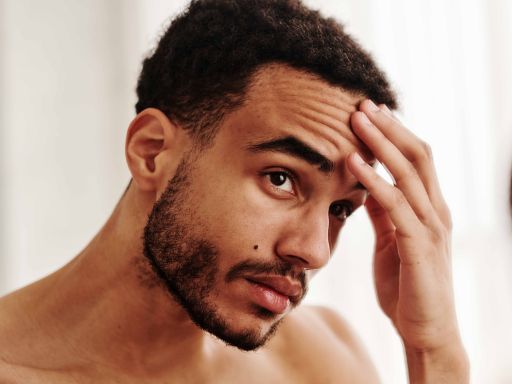 Top 10 causas de rugas na testa e como tratar (Guia Completo)
